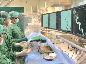 โรงพยาบาลศรีนครินทร์ คณะแพทยศาสตร์ มหาวิทยาลัยขอนแก่นสู่ความเป็นเลิศด้านการรักษาภาวะเส้นเลือดสมองแดงดำเชื่อมต่อผิดปกติ (AVM) ด้วยเทคนิคผ่านสายสวน